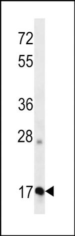 Apolipoprotein O Antibody in Western Blot (WB)