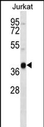 MARCH4 Polyclonal Antibody