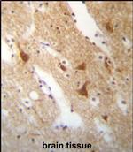 HuC Polyclonal Antibody