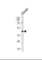 HuC Antibody in Western Blot (WB)