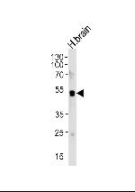 HuC Antibody in Western Blot (WB)