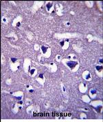 CCDC117 Polyclonal Antibody