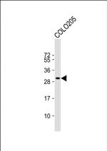 CCDC117 Antibody in Western Blot (WB)