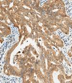 NY-ESO-1 Polyclonal Antibody