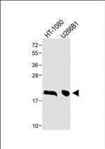 NY-ESO-1 Antibody in Western Blot (WB)