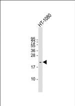 NY-ESO-1 Antibody in Western Blot (WB)