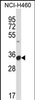 CD16 Antibody in Western Blot (WB)