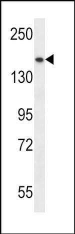 SMC1 Polyclonal Antibody