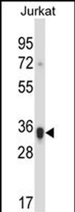 KIR2D Antibody in Western Blot (WB)