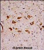 PAK7 Polyclonal Antibody