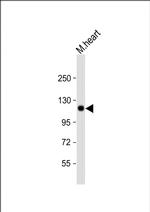 SCYL2 Polyclonal Antibody
