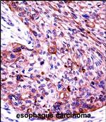 Cytokeratin 6 Polyclonal Antibody