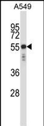 Cytokeratin 6 Antibody in Western Blot (WB)