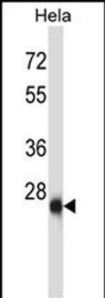 ZIC4 Polyclonal Antibody
