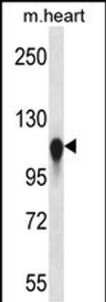 Kinesin 5C Polyclonal Antibody