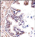 TMPRSS13 Polyclonal Antibody