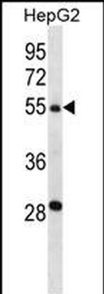 TMPRSS13 Antibody in Western Blot (WB)