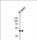 MOS Polyclonal Antibody