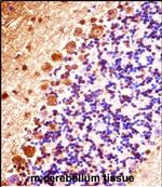 STK32B Polyclonal Antibody