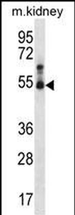 STK32B Antibody in Western Blot (WB)