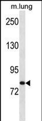 HUNK Polyclonal Antibody
