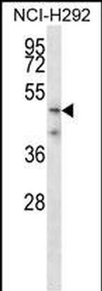 Spinesin Polyclonal Antibody
