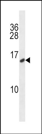 Calcitonin Polyclonal Antibody