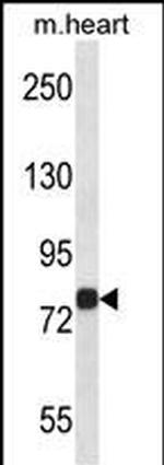 MAP4K2 Antibody in Western Blot (WB)