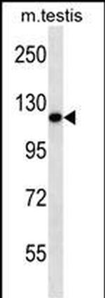 ERN2 Polyclonal Antibody