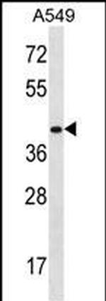 HOXD11 Antibody in Western Blot (WB)