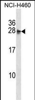 MOCS2 Polyclonal Antibody