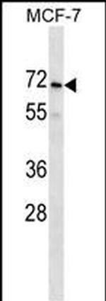 PRAMEF2 Polyclonal Antibody