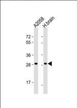 OR4F17 Polyclonal Antibody