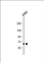 TEC Polyclonal Antibody