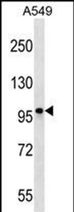 CCDC141 Polyclonal Antibody