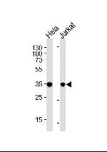 FRG1 Polyclonal Antibody