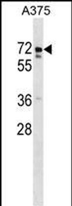 USP17L2 Polyclonal Antibody