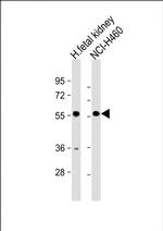 XKRX Polyclonal Antibody