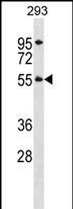 TTC8 Polyclonal Antibody