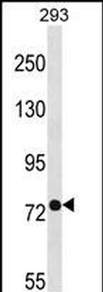 PHEX Polyclonal Antibody