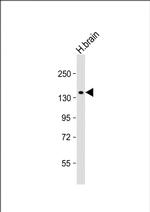 MTMR4 Polyclonal Antibody