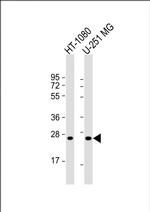 ULBP2 Polyclonal Antibody