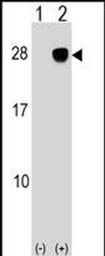 ULBP2 Antibody in Western Blot (WB)