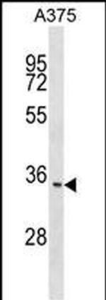 ITM2C Polyclonal Antibody
