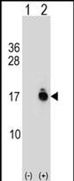 ACYP1 Polyclonal Antibody