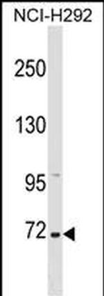 ZNF571 Antibody in Western Blot (WB)