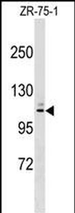 MARCH10 Polyclonal Antibody