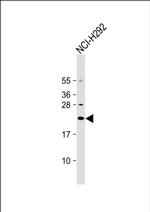 DNAJC5G Polyclonal Antibody