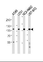 ZNF41 Polyclonal Antibody
