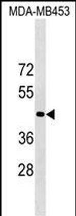 OR1N2 Polyclonal Antibody